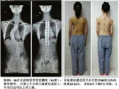 加固效果評估的實際案例，加固效果評估的實際案例分析 行業(yè)新聞 第4張