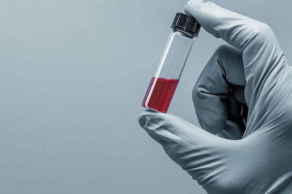 加固材料性能指標(biāo)標(biāo)準(zhǔn) 行業(yè)新聞 第3張 加固材料性能指標(biāo)標(biāo)準(zhǔn) 行業(yè)新聞 第3張